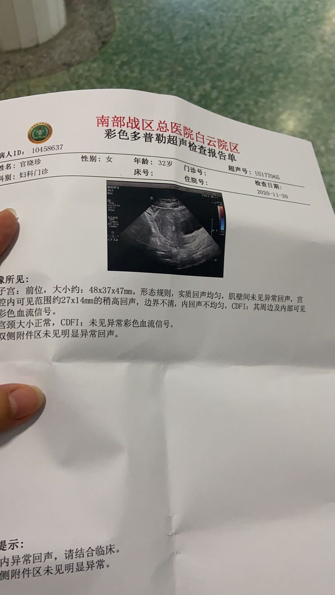 如何从供卵试管婴儿丈夫那里获得精子