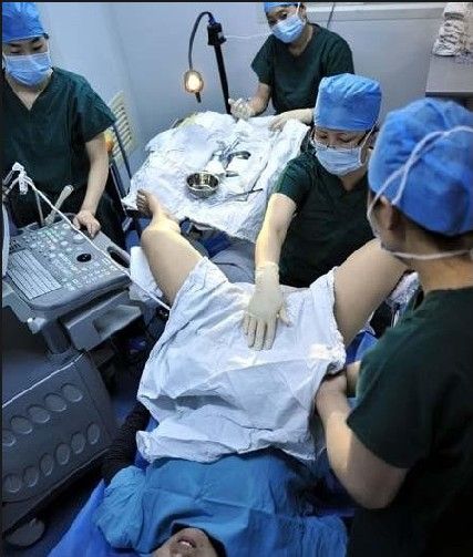 单身女性去美国借卵做试管代怀供卵合法吗？其过程是怎样的？