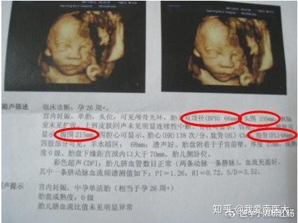 湖南长沙湖南医院供卵做试管婴儿论坛