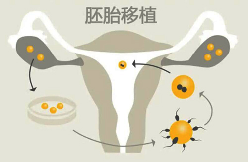 做供卵试管为什么要做宫腔镜检查