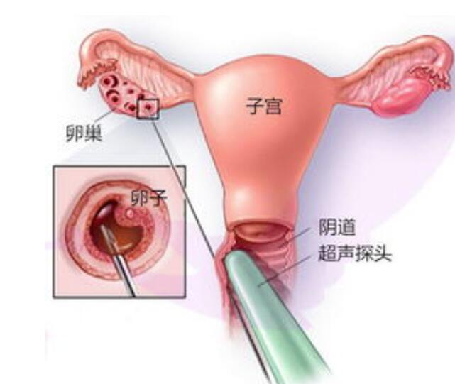 长沙山大能做供卵试管