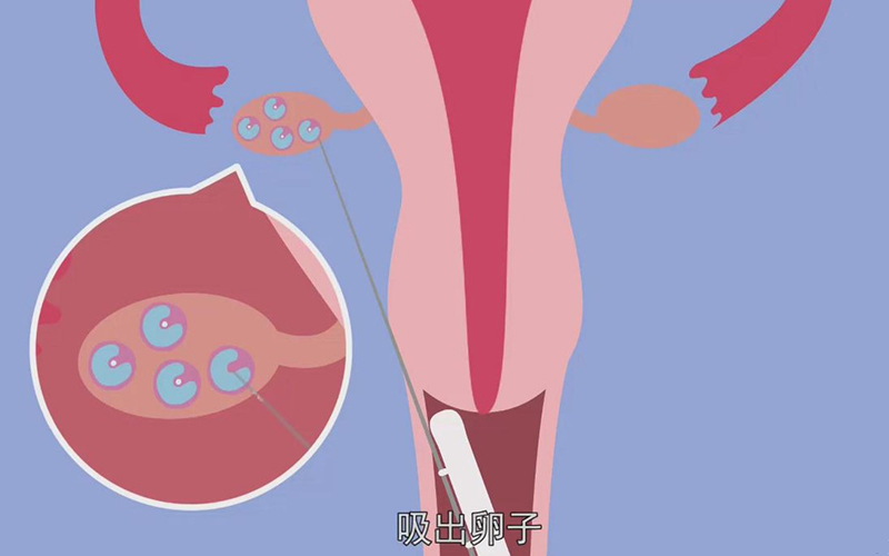 做供卵试管婴儿可以知道性别吗