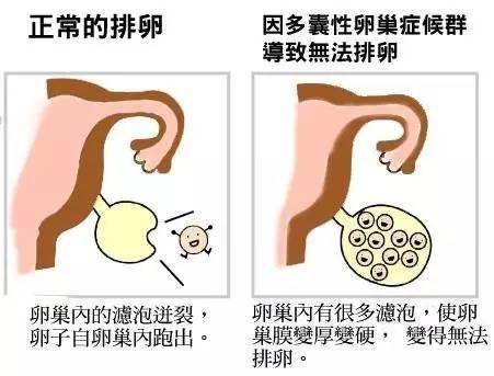 能不能怀孕,还要看输卵管的这两个功能!