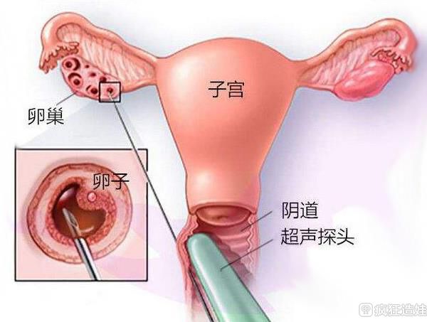 长沙妇幼保健院做试管怎么样？从哪些角度来评判？