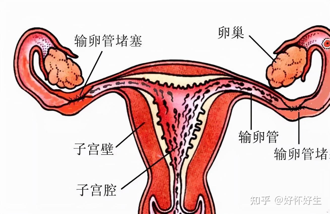 湖南婴儿试管价格（流程有哪些？）