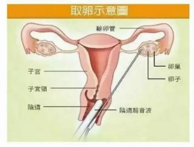 湖南代怀包成功费用标准的费用是多少（大概需要交多少次？）