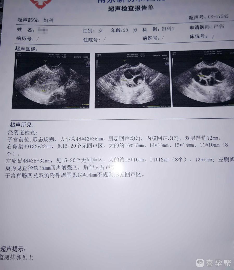 女性子宫先天性畸形能正规医院做供卵要多少