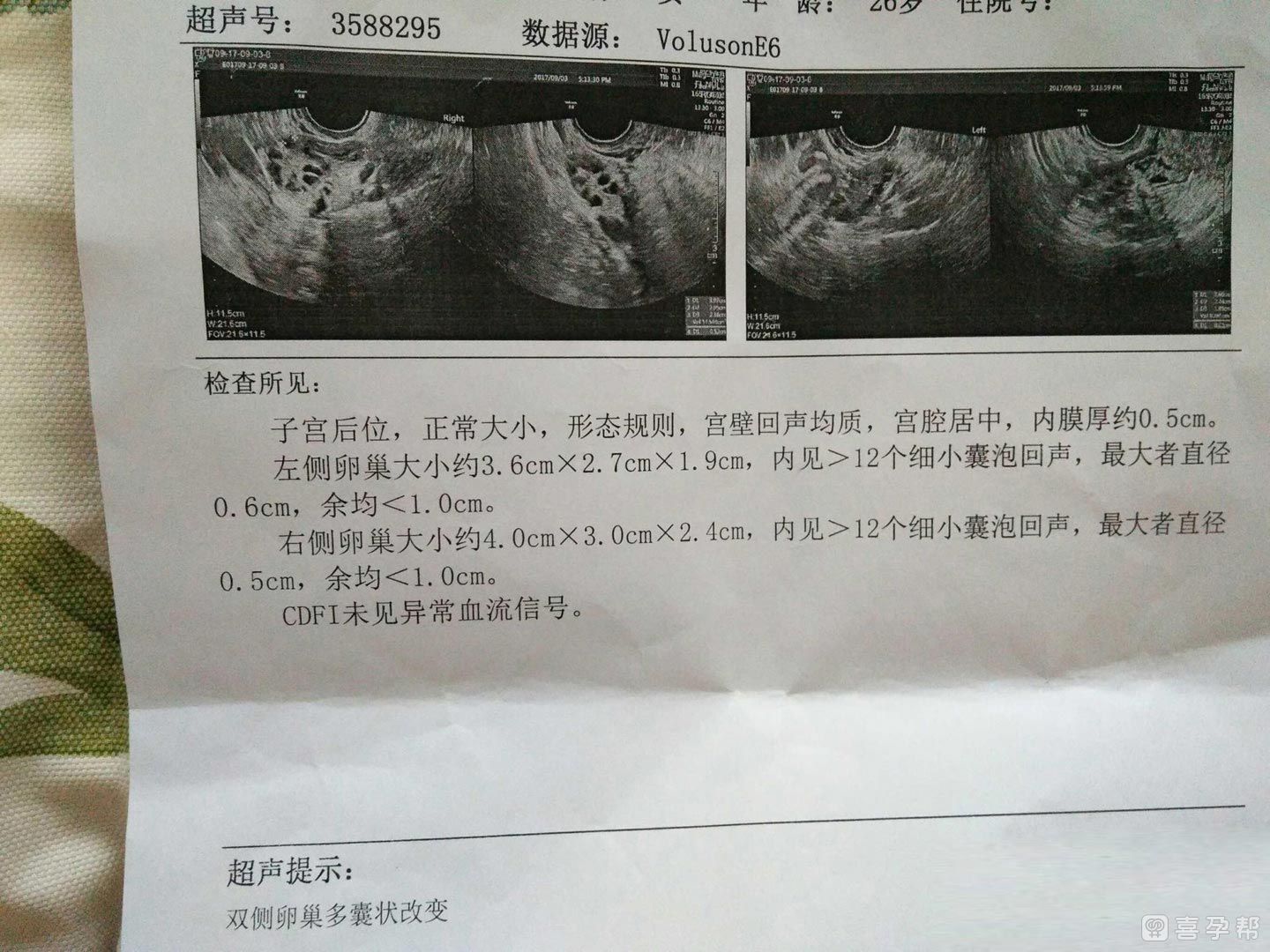 55岁还可以试管生子公司电话婴儿吗
