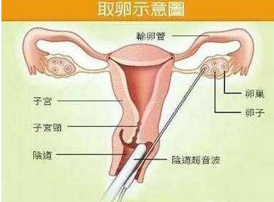 为什么不建议12月龄宝宝打水痘疫苗,医生道出其中端倪